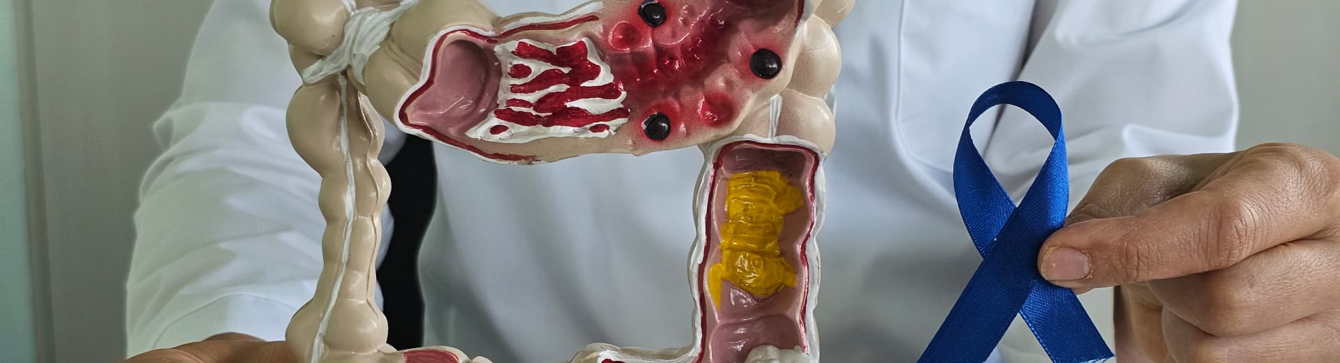 Colon cancer awareness and prevention