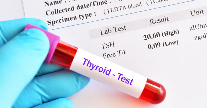 Thyroid Disorders Symptoms and Diagnosis